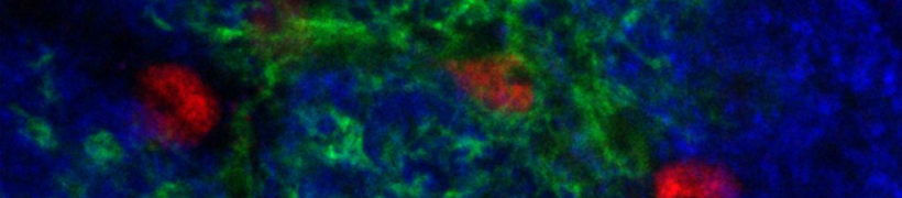 The funding awarded to Alessia Soldano, researcher at SISSA and Director of the School’s Neurogenetics Laboratory, amounts to a substantial €1,653,000.