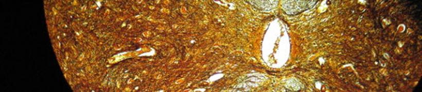neurvi_spinali_792X175.jpg