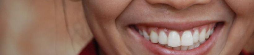 sorriso_712X175.jpg